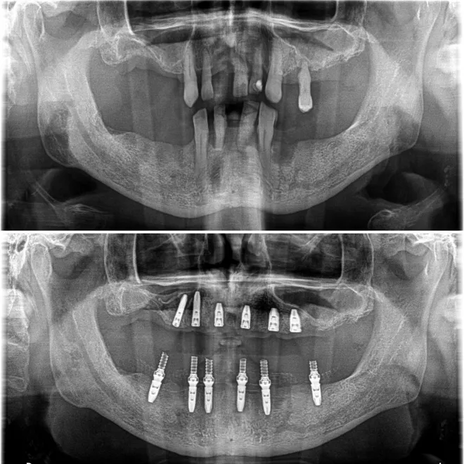 Cabinet spécialisé en implants dentaires : des mesures d’hygiènes strictes et des équipements derniers cris