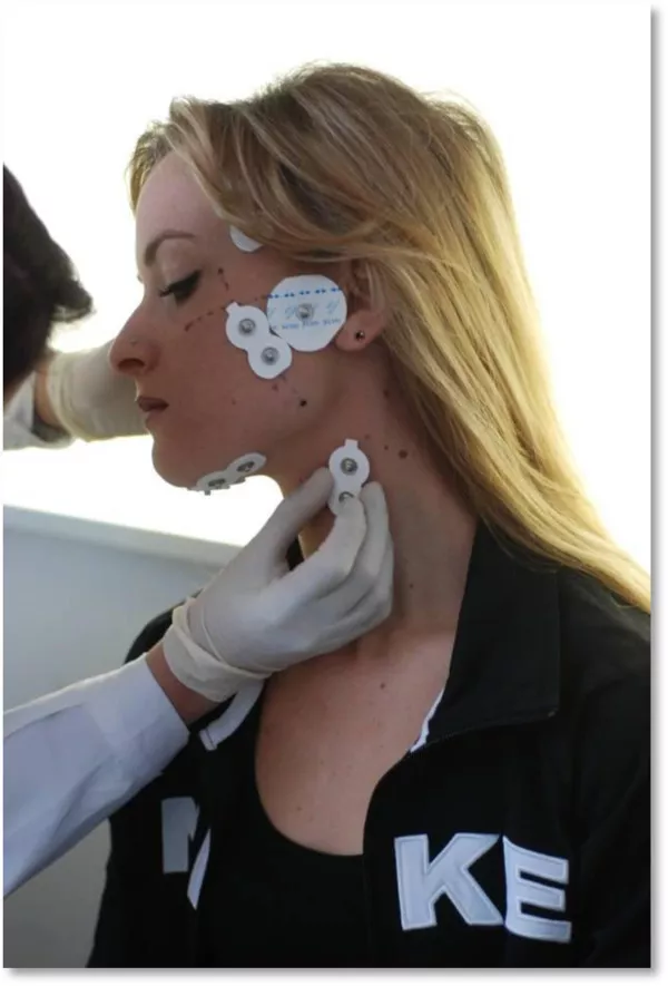 TENS ou Neurostimulation électrique transcutanée