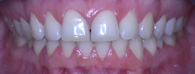 spécialisation en endodontie, chirurgie bucco-dentaire et implant dentaire à Gembloux